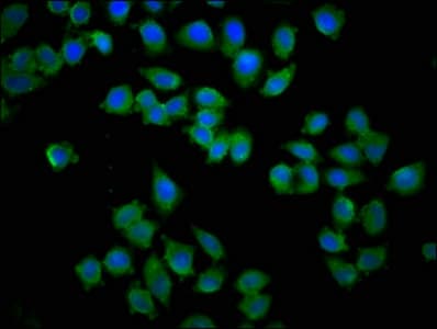 KY Antibody