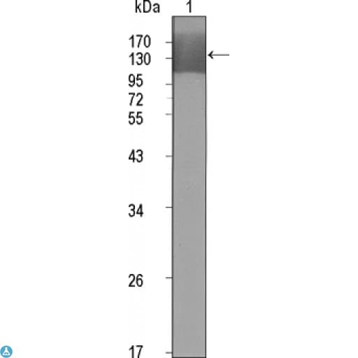 KDR / VEGFR2 / FLK1 Antibody