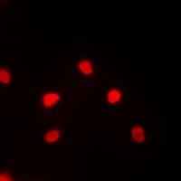 Polyclonal Rabbit anti-Human MEF2C Antibody (C-Terminus, IHC, IF, WB)