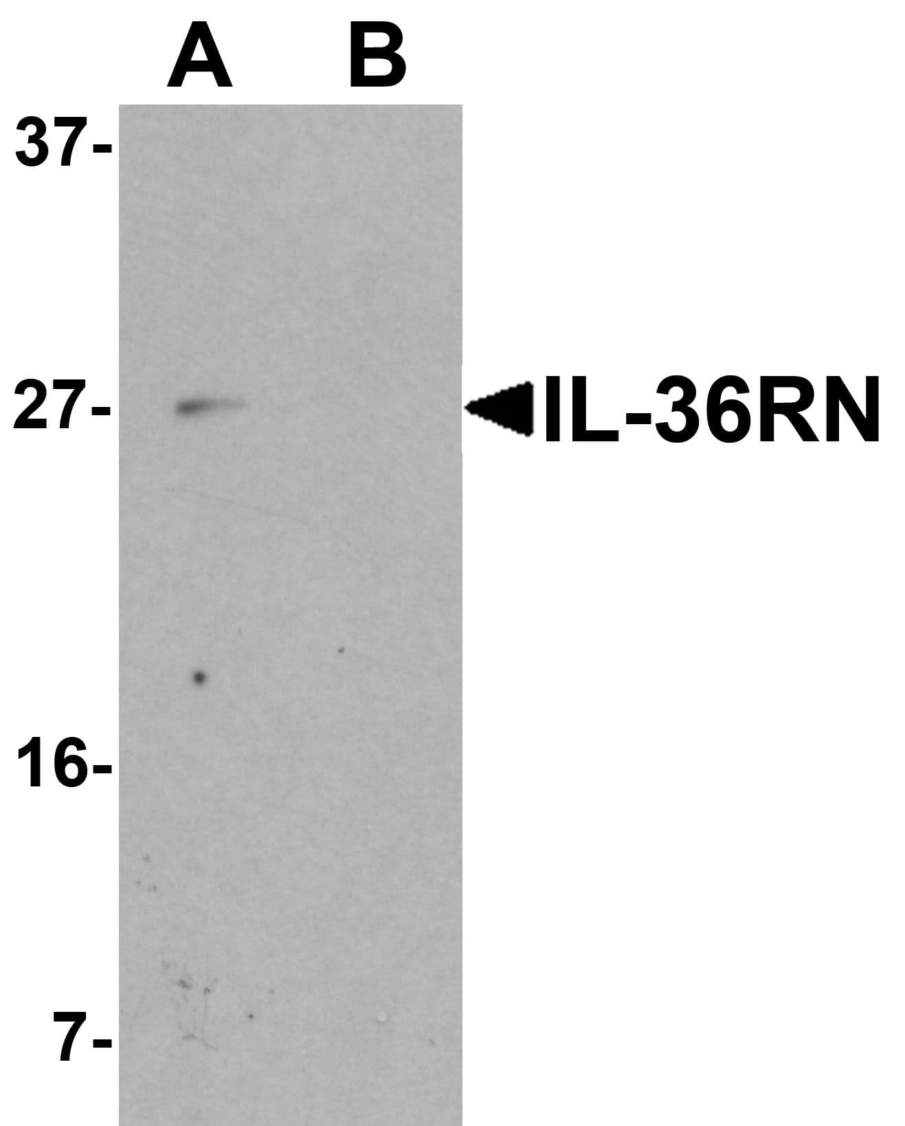 IHC-plus™ IL36RN / IL1F5 Antibody