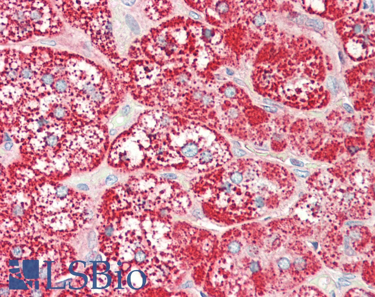 IHC-plus™ SLC47A1 / MATE1 Antibody (aa492-519)