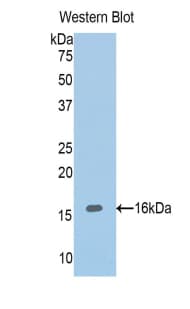 ADAMTS1 Antibody (aa854-967)