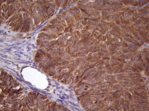 NDUFB11 Antibody (aa30-163, clone OTI9C5)