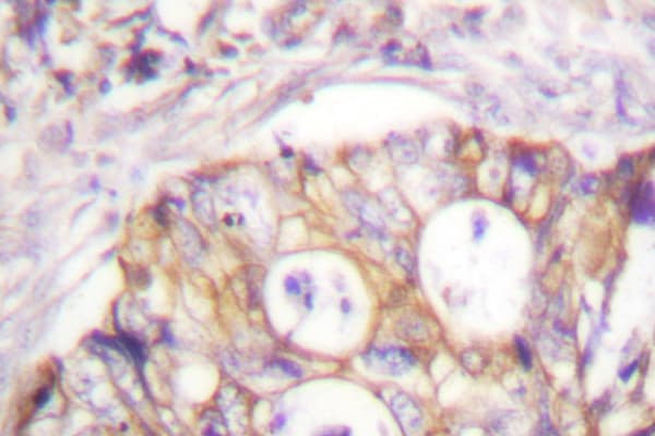 KRT8 / CK8 / Cytokeratin 8 Antibody (Gly427)