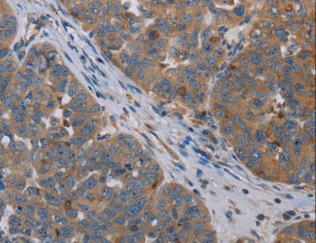OTOR / Otoraplin Antibody