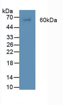 BMPR2 Antibody (aa27-150)