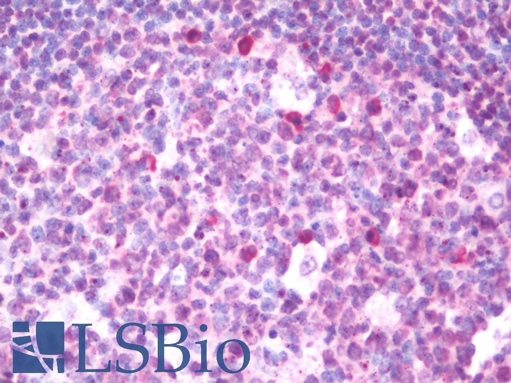 IHC-plus™ ETS2 Antibody (aa146-173)