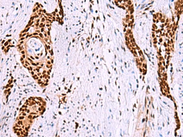 Polyclonal Rabbit anti-Human ISY1-RAB43 Antibody (IHC, WB)