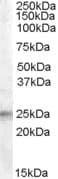 IHC-plus™ IGFBP6 Antibody (aa128-141)