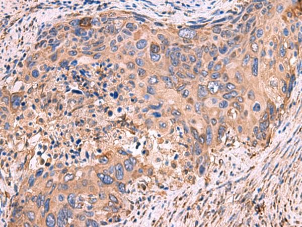 GUSB / Beta Glucuronidase Antibody