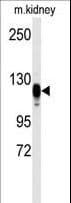 IHC-plus™ Polyclonal Rabbit anti-Human EGFR Antibody (Ser1070, IHC, WB)