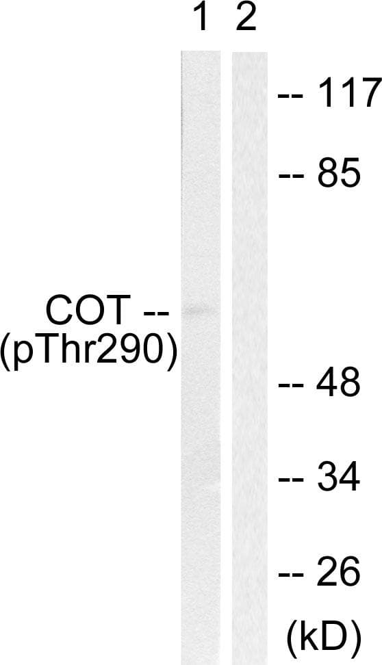 Polyclonal Rabbit anti-Human MAP3K8 / TPL2 Antibody (phospho-Thr290, IHC, IF, WB)