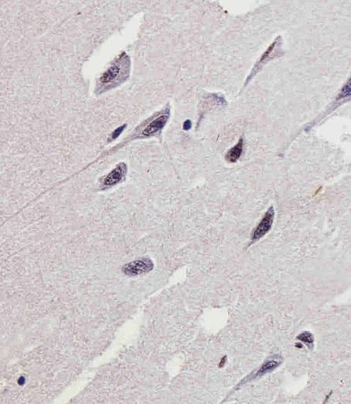 PTK2B / PYK2 Antibody (aa805-838)