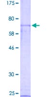 Human NR0B1 / DAX1 Protein (Recombinant GST)