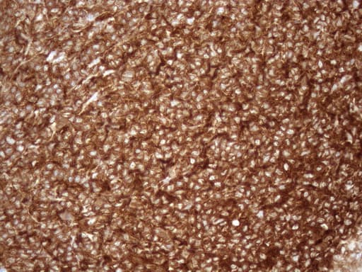 URP2 / FERMT3 Antibody (aa259-528, clone OTI3C7)
