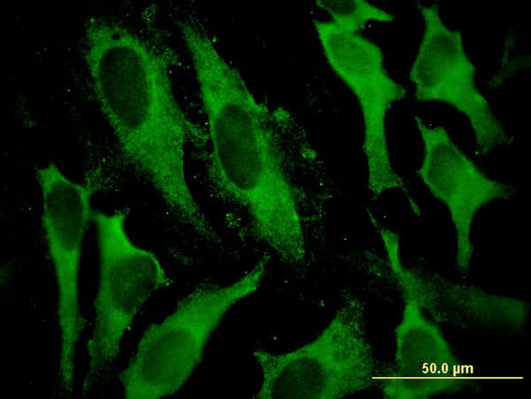 Monoclonal Mouse anti-Human GSTA2 Antibody (clone 3D4, IF, WB)
