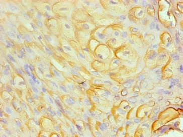 S100A8 / MRP8 Antibody (clone 1A1C1)
