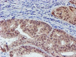 VCAM1 / CD106 Antibody (clone OTI4E8)