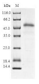 Human SOD3 Protein (Recombinant)