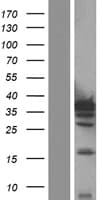 IL-1B / IL-1 Beta Protein (Over-Expression Lysate Myc-DDK (Flag))