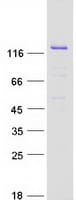 Human RASGRF1 / CDC25 Protein (Recombinant Myc-DDK (Flag))