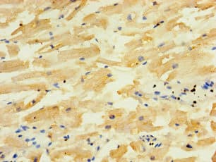 ALG5 Antibody