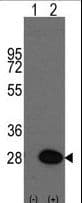 HSPB1 / HSP27 Antibody (Ser83)