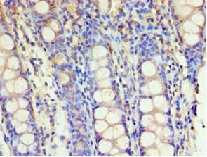 GSTM4-4 / GSTM4 Antibody (aa1-218)