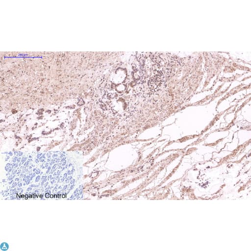 Monoclonal Mouse anti-Human TUBG1 / Tubulin Gamma 1 Antibody (IHC)