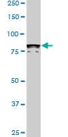 Monoclonal Mouse anti-Human DYRK / DYRK1A Antibody (clone 7D10, WB)
