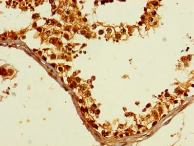 Polyclonal Rabbit anti-Human TFIIB Antibody (WB)