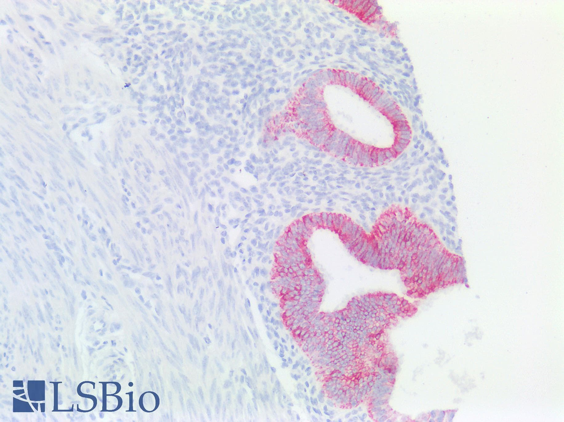 PathPlus™ KRT18 / CK18 / Cytokeratin 18 Antibody (aa48-97)