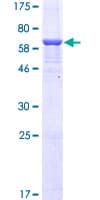 Human FTHFSDC1 / MTHFD1L Protein (Recombinant GST)