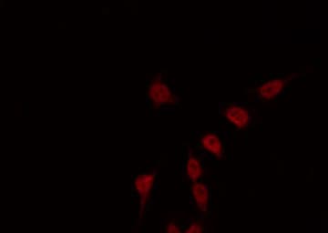 Polyclonal Rabbit anti-Human RPS6KB2 / S6K2 Antibody (IF, WB)