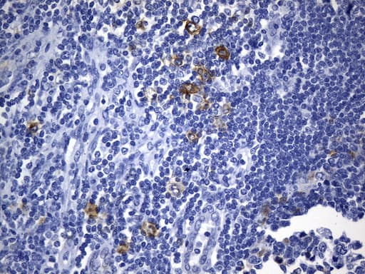 Monoclonal Mouse anti-Human CD30 Antibody (clone UMAB256, aa408-595, IHC, WB)