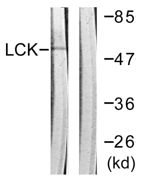 p56lck / LCK Antibody (aa161-210)