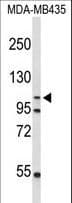 GEN1 Antibody (aa60-89)