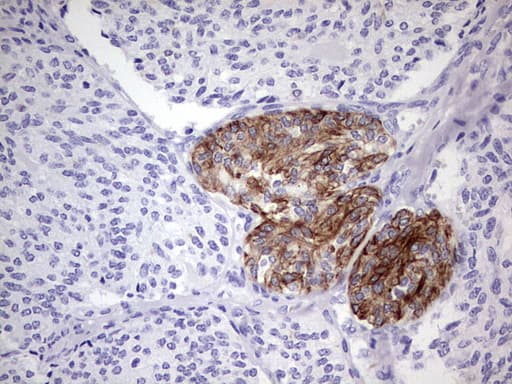 Monoclonal Mouse anti-Human KRT19 / CK19 / Cytokeratin 19 Antibody (clone OTI1F5, aa240-390, IHC, WB)