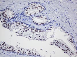 TRMT2A Antibody (clone OTI2A1)