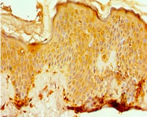 Polyclonal Rabbit anti-Human EFTUD2 Antibody (IHC)