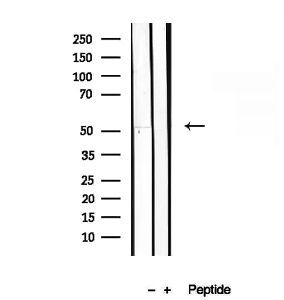 Gasdermin D / GSDMD Antibody