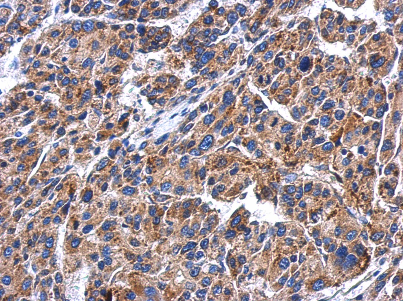 GBA / Glucosidase Beta Acid Antibody (aa65-384)