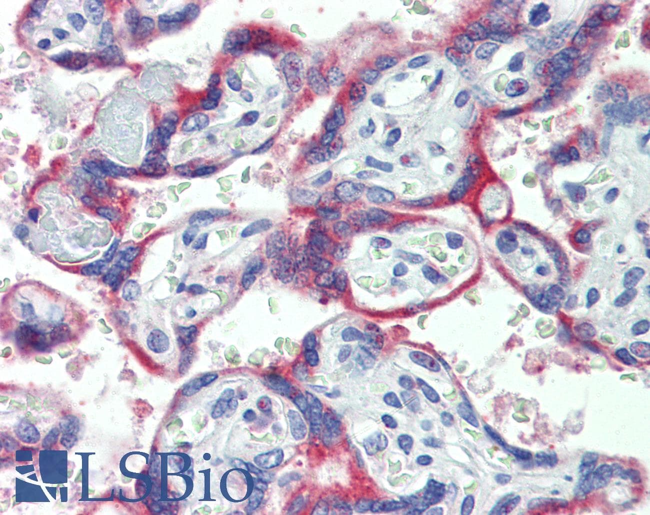 IHC-plus™ CYBB / NOX2 / gp91phox Antibody (aa151-163)