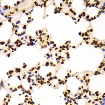 Polyclonal Rabbit anti-Human Histone H3 Antibody (Di-Methyl-Lys4, IHC, IF, WB)