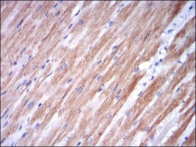 Monoclonal Mouse anti-Human TNNI2 Antibody (clone 2F12A8, IHC, WB)