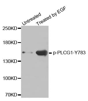 Polyclonal Rabbit anti-Human PLCG1 Antibody (phospho-Tyr783, WB)