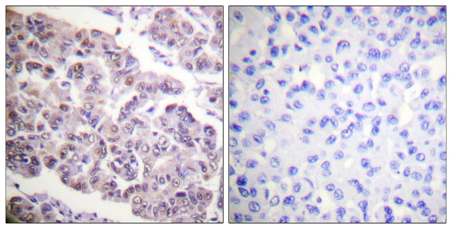 Histone H4 Antibody (Acetyl-Lys12)
