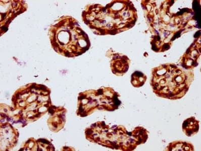 FZD3 / Frizzled 3 Antibody