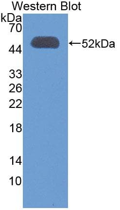 OXCT1 Antibody (aa40-489)