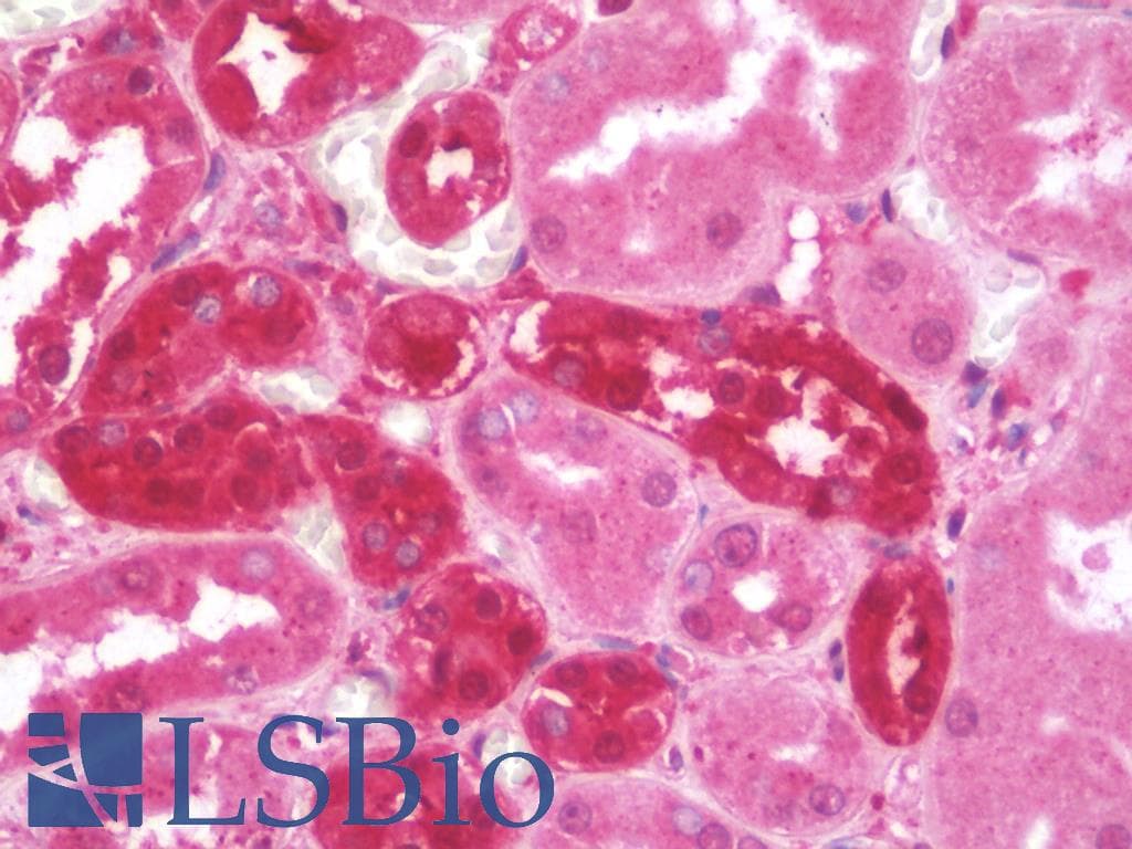 Polyclonal Rabbit anti-Human NRAS / N-ras Antibody (IHC, WB)